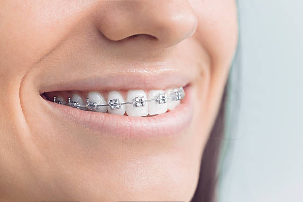 Best Dentures (Full and Partial)  in Wesley Chapel, NC
